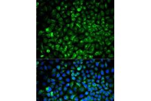 Immunofluorescence analysis of U2OS cells using COMT Polyclonal Antibody (COMT anticorps)