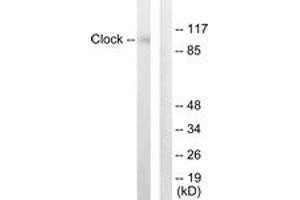 Western blot analysis of extracts from HuvEc cells, using Clock Antibody. (CLOCK anticorps  (AA 241-290))