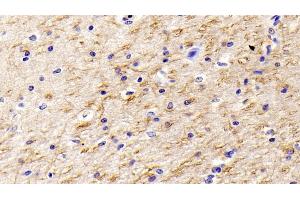 Detection of NGF in Human Cerebrum Tissue using Monoclonal Antibody to Nerve Growth Factor (NGF)