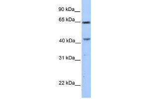 CCDC60 antibody used at 1 ug/ml to detect target protein. (CCDC60 anticorps  (C-Term))