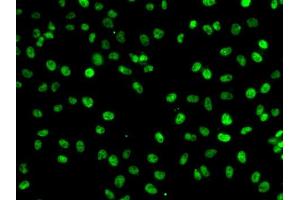 Immunofluorescence analysis of A-549 cells using PHF19 antibody (ABIN6128441, ABIN6145539, ABIN6145540 and ABIN6224090).