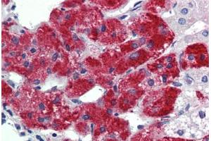 Human Adrenal: Formalin-Fixed, Paraffin-Embedded (FFPE)