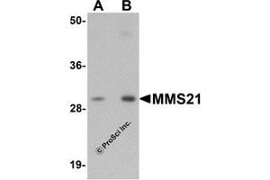 Western Blotting (WB) image for anti-E3 SUMO-Protein Ligase NSE2 (NSMCE2) (C-Term) antibody (ABIN1030522) (NSMCE2 anticorps  (C-Term))