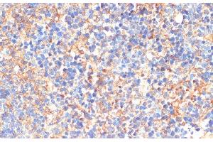 Immunohistochemistry of paraffin-embedded Mouse spleen using SIGLEC3/CD33 Polyclonal Antibody at dilution of 1:200 (40x lens).