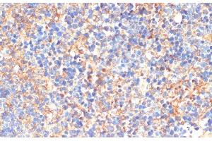 Immunohistochemistry of paraffin-embedded Mouse spleen using SIGLEC3/CD33 Polyclonal Antibody at dilution of 1:200 (40x lens). (CD33 anticorps)