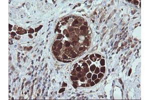 Image no. 4 for anti-Tripartite Motif Containing 44 (TRIM44) antibody (ABIN1501505) (TRIM44 anticorps)