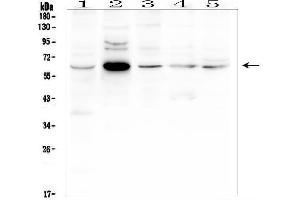 Western blot analysis of EGFL6 using anti-EGFL6 antibody (ABIN6719596).