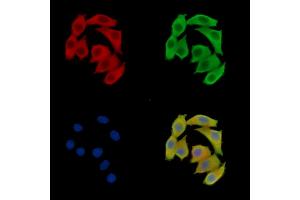 ABIN7095504 and ABIN7099561 staining Hela cells by IF/ICC. (VMP1 anticorps)