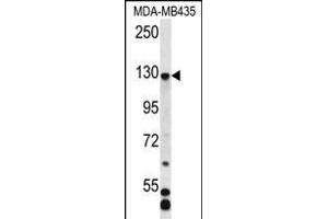 C7orf63 Antibody (N-term) (ABIN656362 and ABIN2845659) western blot analysis in MDA-M cell line lysates (35 μg/lane). (C7orf63 anticorps  (N-Term))