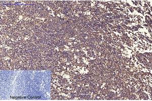 Immunohistochemical analysis of paraffin-embedded human tonsil tissue. (Ubiquitin anticorps)