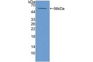 Detection of Recombinant ABCA13, Mouse using Polyclonal Antibody to ATP Binding Cassette Transporter A13 (ABCA13)
