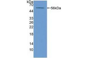Detection of Recombinant ABCA13, Mouse using Polyclonal Antibody to ATP Binding Cassette Transporter A13 (ABCA13) (ABCA13 anticorps  (AA 4692-4931))