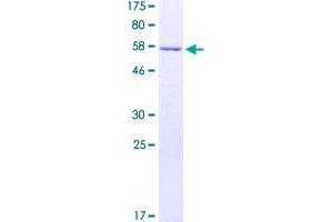 Image no. 1 for U11/U12 SnRNP 35 KDa Protein (AA 1-251) protein (GST tag) (ABIN1320814)