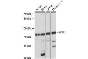 Western blot analysis of extracts of various cell lines, using POT1 antibody (ABIN3022020, ABIN3022021, ABIN5663924 and ABIN6218570) at 1:1000 dilution. (POT1 anticorps  (AA 497-634))