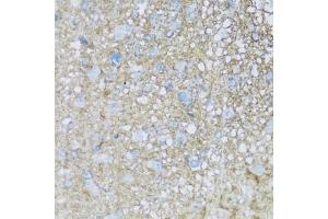 Immunohistochemistry of paraffin-embedded rat brain using B2 antibody (ABIN7265773) at dilution of 1:100 (40x lens).