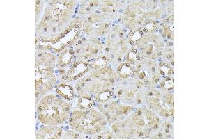 Immunohistochemistry of paraffin-embedded mouse kidney using PSMB3 antibody (ABIN6131929, ABIN6146317, ABIN6146318 and ABIN6225280) at dilution of 1:100 (40x lens).