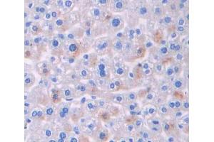 Used in DAB staining on fromalin fixed paraffin- embedded liver tissue