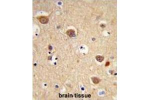 Immunohistochemistry (IHC) image for anti-Apoptosis-Inducing Factor, Mitochondrion-Associated, 1 (AIFM1) antibody (ABIN3003960) (AIF anticorps)