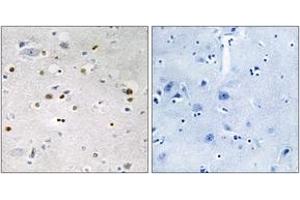 Immunohistochemistry analysis of paraffin-embedded human brain tissue, using ZNF7 Antibody. (ZNF7 anticorps  (AA 41-90))