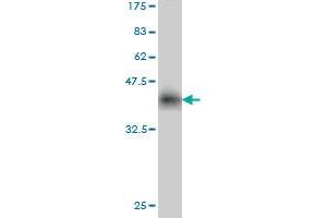 Western Blot detection against Immunogen (37.