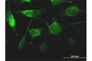 Immunofluorescence of monoclonal antibody to FTL on HeLa cell. (FTL anticorps)