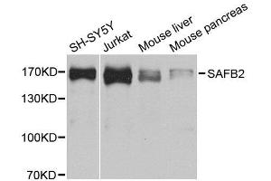 Western blot analysis of extracts of various cell lines, using SAFB2 antibody.