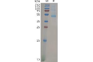 Human KRAS Protein, mFc Tag on SDS-PAGE under reducing condition.
