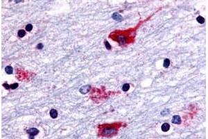 Immunohistochemical staining of human brain, neurons and glia with CHRM2 polyclonal antibody . (Muscarinic Acetylcholine Receptor M2 anticorps  (Cytoplasmic Domain))