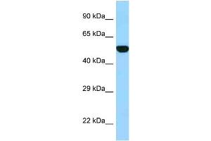 WB Suggested Anti-FPGS Antibody Titration: 1. (FPGS anticorps  (Middle Region))