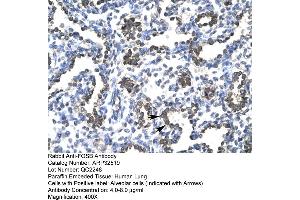 Human Lung (FOSB anticorps  (C-Term))