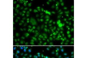 Immunofluorescence analysis of MCF-7 cells using NSUN6 Polyclonal Antibody (NSUN6 anticorps)