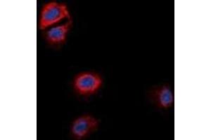 Immunofluorescent analysis of GPR170 staining in MCF7 cells. (OXER1 anticorps)