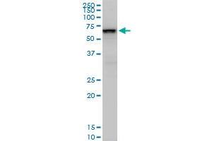 SMARCD2 monoclonal antibody (M02), clone 2B2.