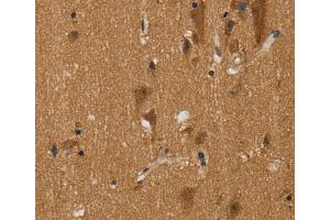 Immunohistochemistry (IHC) image for anti-Nerve Growth Factor Receptor (TNFRSF16) Associated Protein 1 (NGFRAP1) antibody (ABIN2430496) (Nerve Growth Factor Receptor (TNFRSF16) Associated Protein 1 (NGFRAP1) anticorps)