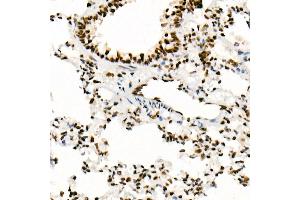 Immunohistochemistry of paraffin-embedded Rat lung using SM/SNF5 antibody (ABIN7270657) at dilution of 1:1000 (40x lens).