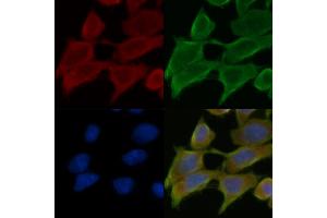 ABIN7095313 and ABIN7099370 staining Hela cells(45 min of heat-shock treatment) by IF/ICC. (C2CD2 anticorps)