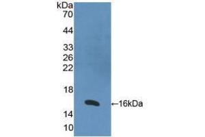 Western blot analysis of recombinant Human RARa. (Retinoic Acid Receptor alpha anticorps  (AA 68-173))