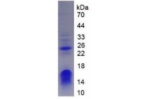 SDS-PAGE analysis of Human CHD3 Protein. (CHD3 Protéine)