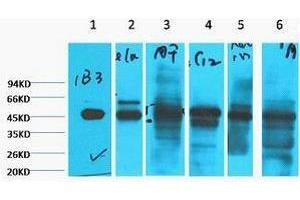 Western Blotting (WB) image for anti-Keratin 18 (KRT18) antibody (ABIN3178648) (Cytokeratin 18 anticorps)