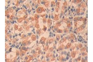 Detection of CYR61 in Human Stomach Tissue using Polyclonal Antibody to Cysteine Rich Protein, Angiogenic Inducer 61 (CYR61)