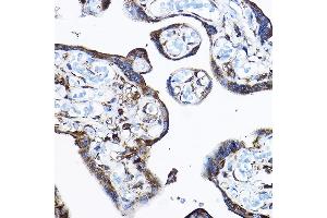 Immunohistochemistry of paraffin-embedded human placenta using RPL17 Rabbit pAb (ABIN6128342, ABIN6147115, ABIN6147116 and ABIN6221632) at dilution of 1:100 (40x lens).
