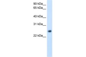Western Blotting (WB) image for anti-gamma-Glutamyltransferase Light Chain 1 (GGTLC1) antibody (ABIN2462441)