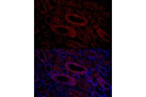 Immunofluorescence analysis of human kidney cells using  Rabbit pAb (ABIN3016811, ABIN3016812, ABIN3016813, ABIN1678723 and ABIN6219847) at dilution of 1:150 (40x lens).