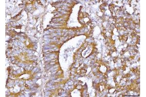 IHC analysis of ABP1/AOC1 using anti-ABP1/AOC1 antibody (ABIN4886460).