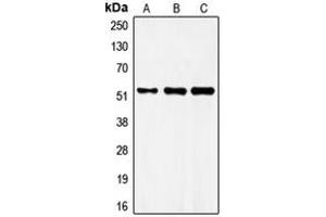 Western blot analysis of FRS3 expression in MCF7 (A), mouse brain (B), rat brain (C) whole cell lysates. (FRS3 anticorps  (Center))