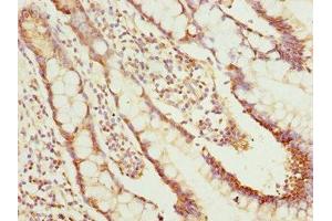 Immunohistochemistry of paraffin-embedded human small intestine tissue using ABIN7161726 at dilution of 1:100