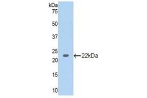 Detection of Recombinant GAPDH, Human using Polyclonal Antibody to Glyceraldehyde-3-Phosphate Dehydrogenase (GAPDH) (GAPDH anticorps  (AA 154-324))