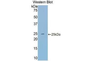 Western blot analysis of the recombinant protein. (Transferrin anticorps  (AA 22-176))