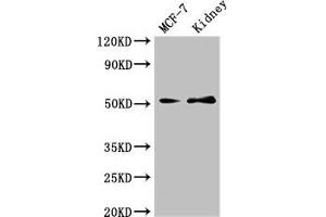 Western Blot Positive WB detected in: MCF-7 whole cell lysate, Mouse kidney tissue All lanes: GFRA1 antibody at 3 μg/mL Secondary Goat polyclonal to rabbit IgG at 1/50000 dilution Predicted band size: 52, 51 kDa Observed band size: 52 kDa (GFRA1 anticorps  (AA 230-385))
