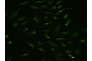 Immunofluorescence of monoclonal antibody to BAG5 on HeLa cell.